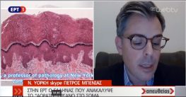 Ο Μεγανησιώτης Γιατρός μέλος της επιστημονικής ομάδας που ανακάλυψε το “αόρατο” οργάνο κατά του καρκίνου Πέτρος Μπενίας στην εκπομπή «Απευθείας» της ΕΡΤ1